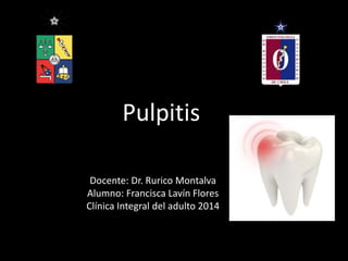 Pulpitis
Docente: Dr. Rurico Montalva
Alumno: Francisca Lavín Flores
Clínica Integral del adulto 2014
 