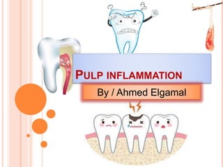PULP INFLAMMATION
By / Ahmed Elgamal
 