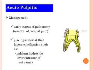 CHRONIC HYPERPLASTIC PULPITIS
 Also called pulp polyp
 Essentially an excessive exuberant proliferation of
chronically i...
