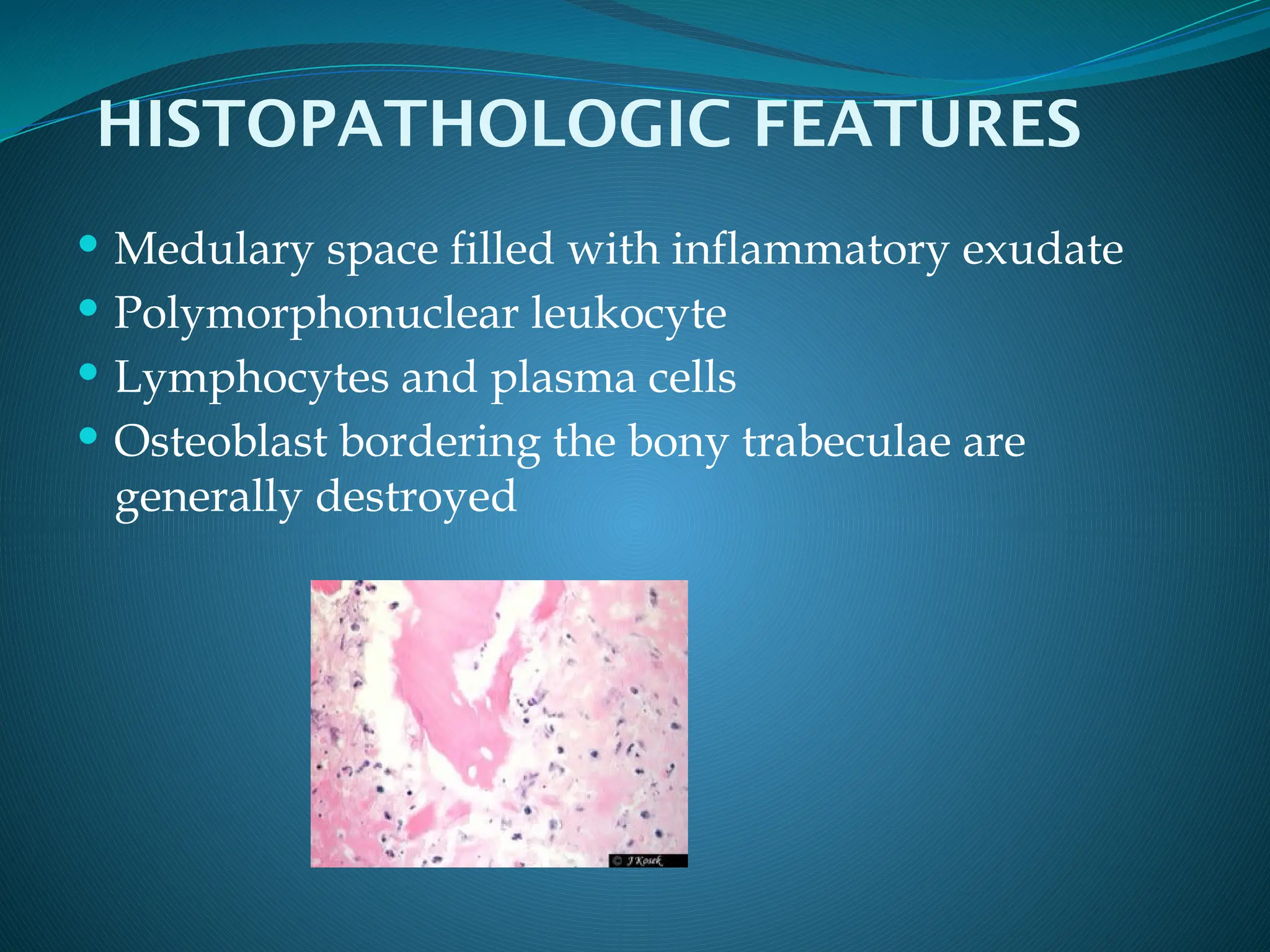pulpitis and osteomyelitis types and classification.pptx