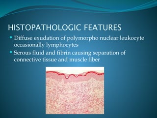 pulpitis and osteomyelitis types and classification.pptx