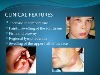 pulpitis and osteomyelitis types and classification.pptx