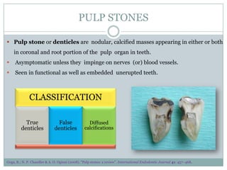 PULP STONES
 Pulp stone or denticles are nodular, calcified masses appearing in either or both
in coronal and root portion of the pulp organ in teeth.


Asymptomatic unless they impinge on nerves (or) blood vessels.



Seen in functional as well as embedded unerupted teeth.

CLASSIFICATION
True
denticles

False
denticles

Diffused
calcifications

Goga, R.; N. P. Chandler & A. O. Oginni (2008). "Pulp stones: a review". International Endodontic Journal 41: 457–468.

 