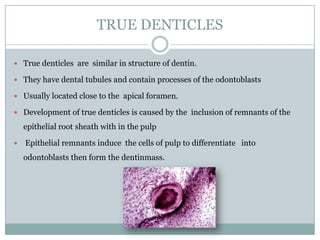 TRUE DENTICLES
 True denticles are similar in structure of dentin.
 They have dental tubules and contain processes of the odontoblasts
 Usually located close to the apical foramen.
 Development of true denticles is caused by the inclusion of remnants of the

epithelial root sheath with in the pulp


Epithelial remnants induce the cells of pulp to differentiate into
odontoblasts then form the dentinmass.

 