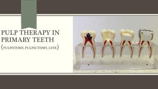 PULP THERAPY IN
PRIMARY TEETH
(PULPOTOMY, PULPECTOMY, LSTR)
 