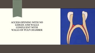 ACCESS OPENING WITH NO
LEDGES AND WALLS
CONFLUENT WITH
WALLS OF PULP CHAMBER
 