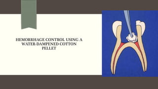HEMORRHAGE CONTROL USING A
WATER-DAMPENED COTTON
PELLET
 