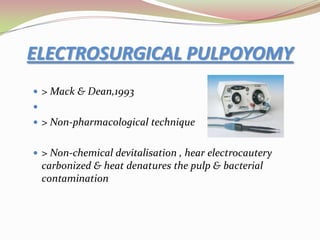 OBJECTIVES FOR Ca(OH)₂ PULPOTOMY OF YOUNG PERMANANT TEETH-:Preserve radicular vitality,Maximize the opportunity for apexogenesis (apical development and closure),Enhance continual root dentin formation..there should be no adverse clinical signs or symptoms of sensitivity, pain or swelling