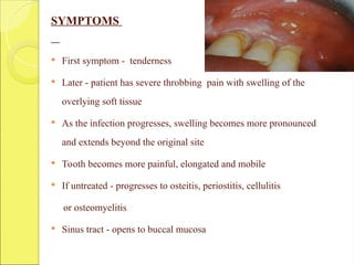 SYMPTOMS
 First symptom - tenderness
 Later - patient has severe throbbing pain with swelling of the
overlying soft tissue
 As the infection progresses, swelling becomes more pronounced
and extends beyond the original site
 Tooth becomes more painful, elongated and mobile
 If untreated - progresses to osteitis, periostitis, cellulitis
or osteomyelitis
 Sinus tract - opens to buccal mucosa
 