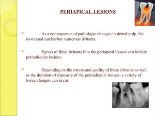 PERIAPICAL LESIONS
 As a consequence of pathologic changes in dental pulp, the
root canal can harbor numerous irritants.
 Egress of these irritants into the periapical tissues can initiate
periradicular lesions.
 Depending on the nature and quality of these irritants as well
as the duration of exposure of the periradicular tissues, a variety of
tissue changes can occur.
 