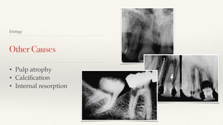 Pulp & periapical disease | PDF