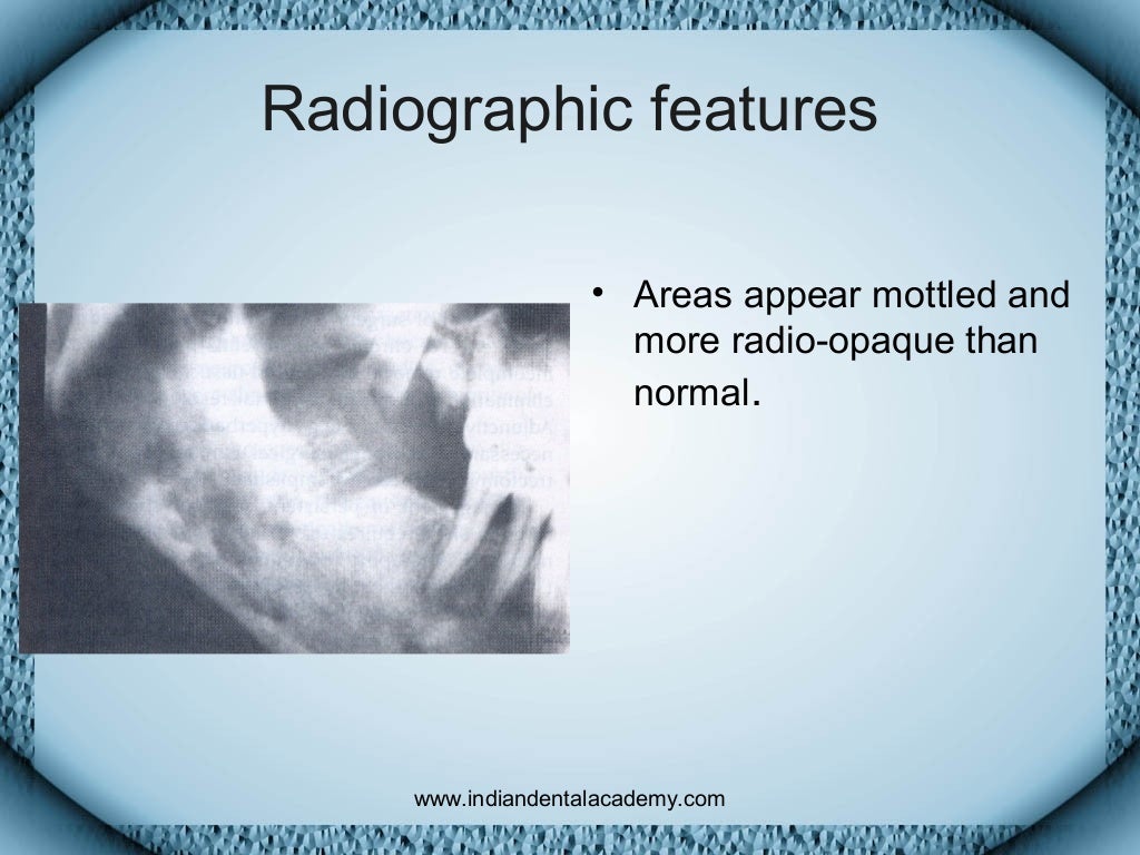OSTEOMYELITIS / dental implant courses