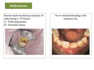 Pulp protection | PPTX