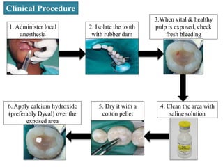 Pulp protection | PPTX