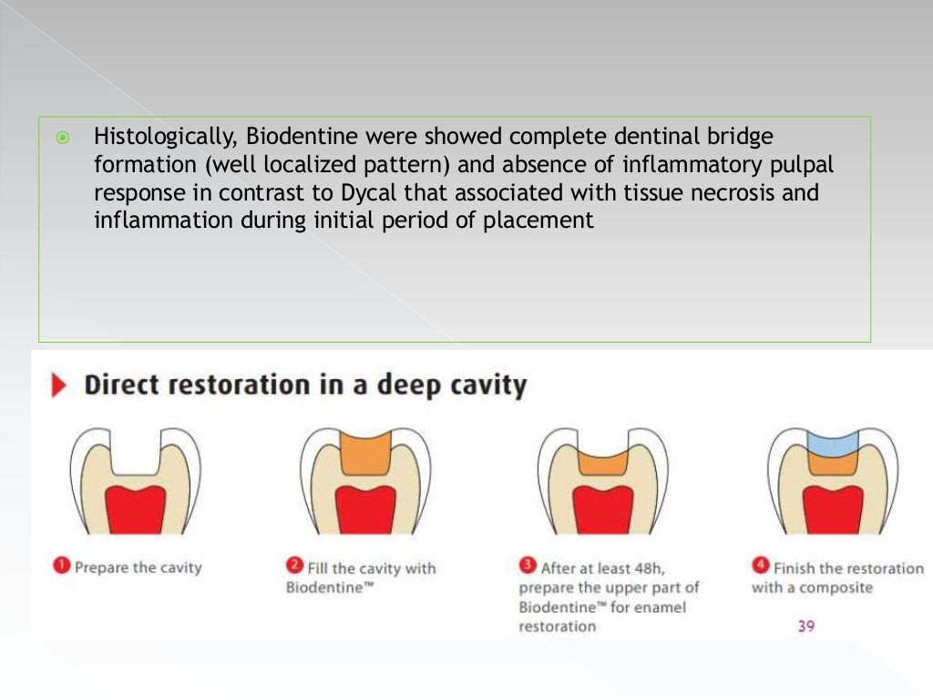 Pulp protection in operative dentistry