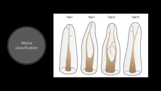 Weine Classification Internal Anatomy of Pulp cavity | PPTX