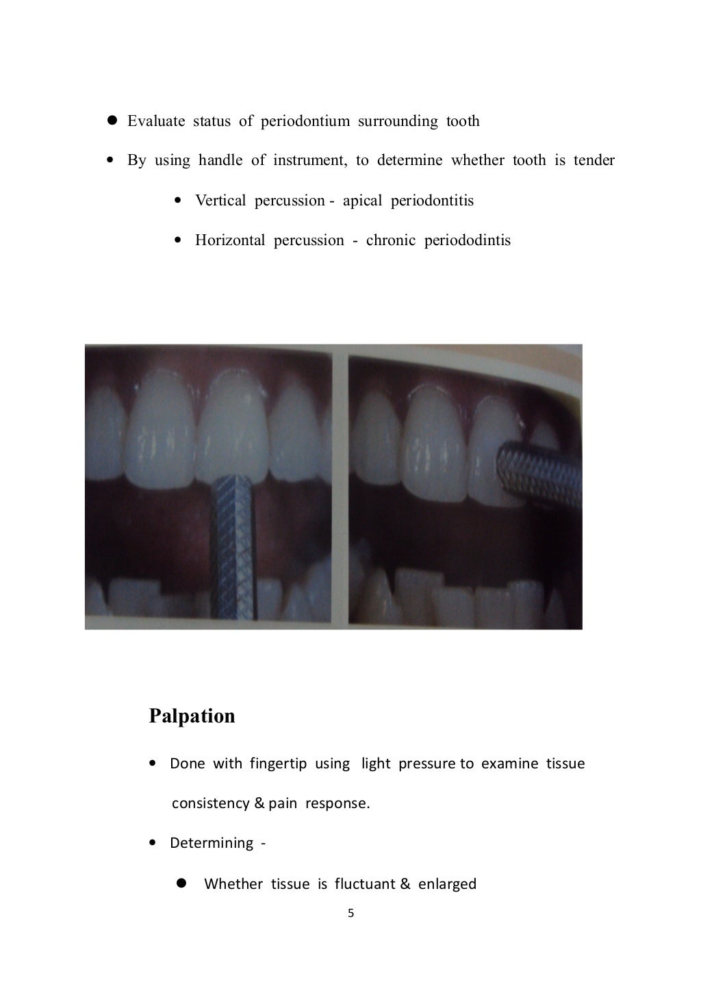 seminar on pulp vitality test