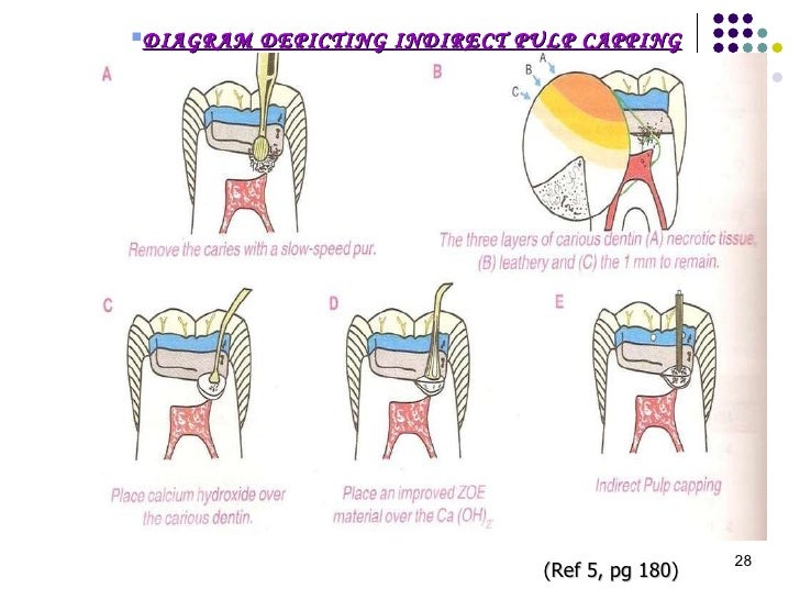 Pulp Therapy by nishtha