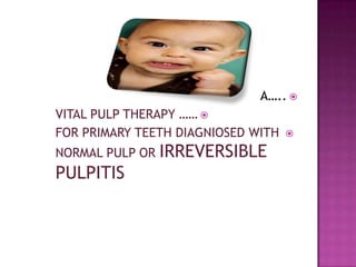 A….. 
VITAL PULP THERAPY …… 
FOR PRIMARY TEETH DIAGNIOSED WITH   

NORMAL PULP OR   IRREVERSIBLE
PULPITIS
 