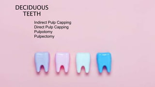 DECIDUOUS
TEETH
Indirect Pulp Capping
Direct Pulp Capping
Pulpotomy
Pulpectomy
 