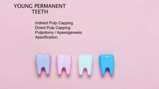 YOUNG PERMANENT
TEETH
Indirect Pulp Capping
Direct Pulp Capping
Pulpotomy / Apexogenesis
Apexification
 