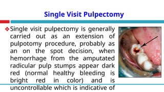 Single Visit Pulpectomy
❖Single visit pulpectomy is generally
carried out as an extension of
pulpotomy procedure, probably as
an on the spot decision, when
hemorrhage from the amputated
radicular pulp stumps appear dark
red (normal healthy bleeding is
bright red in color) and is
uncontrollable which is indicative of
 