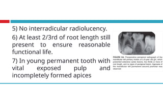 5) No interradicular radiolucency.
6) At least 2/3rd of root length still
present to ensure reasonable
functional life.
7) In young permanent tooth with
vital exposed pulp and
incompletely formed apices
 