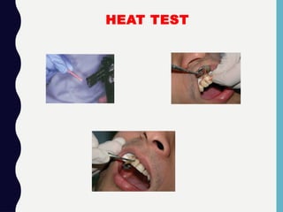 HEAT TEST
 