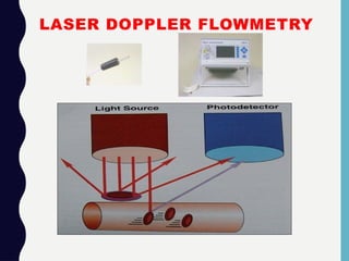 LASER DOPPLER FLOWMETRY
 