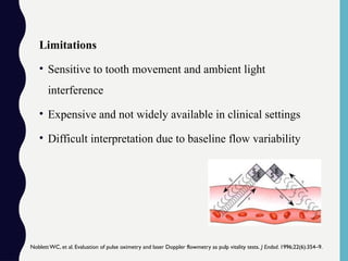 Limitations
• Sensitive to tooth movement and ambient light
interference
• Expensive and not widely available in clinical settings
• Difficult interpretation due to baseline flow variability
NoblettWC, et al. Evaluation of pulse oximetry and laser Doppler flowmetry as pulp vitality tests. J Endod. 1996;22(6):354–9.
 