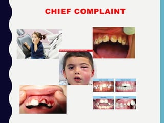 CHIEF COMPLAINT
 