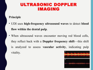 ULTRASONIC DOPPLER
IMAGING
Principle
• UDI uses high-frequency ultrasound waves to detect blood
flow within the dental pulp.
• When ultrasound waves encounter moving red blood cells,
they reflect back with a Doppler frequency shift—this shift
is analyzed to assess vascular activity, indicating pulp
vitality.
 