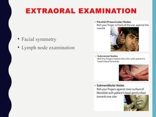 EXTRAORAL EXAMINATION
• Facial symmetry
• Lymph node examination
 
