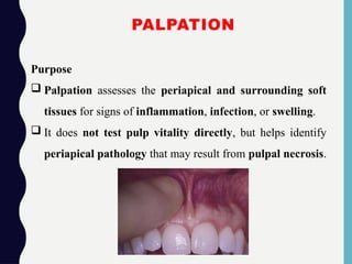 PALPATION
Purpose
 Palpation assesses the periapical and surrounding soft
tissues for signs of inflammation, infection, or swelling.
 It does not test pulp vitality directly, but helps identify
periapical pathology that may result from pulpal necrosis.
 