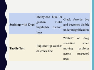 Staining with Dyes
Methylene blue or
gentian violet
highlights fracture
lines
Crack absorbs dye
and becomes visible
under magnification
Tactile Test
Explorer tip catches
on crack line
“Catch” or drag
sensation when
moving explorer
across suspected
area
 