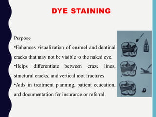 DYE STAINING
Purpose
•Enhances visualization of enamel and dentinal
cracks that may not be visible to the naked eye.
•Helps differentiate between craze lines,
structural cracks, and vertical root fractures.
•Aids in treatment planning, patient education,
and documentation for insurance or referral.
 