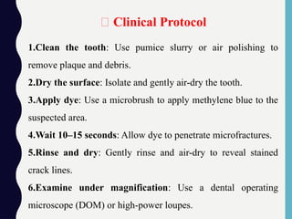 1.Clean the tooth: Use pumice slurry or air polishing to
remove plaque and debris.
2.Dry the surface: Isolate and gently air-dry the tooth.
3.Apply dye: Use a microbrush to apply methylene blue to the
suspected area.
4.Wait 10–15 seconds: Allow dye to penetrate microfractures.
5.Rinse and dry: Gently rinse and air-dry to reveal stained
crack lines.
6.Examine under magnification: Use a dental operating
microscope (DOM) or high-power loupes.
🧰 Clinical Protocol
 