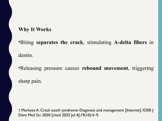 Why It Works
•Biting separates the crack, stimulating A-delta fibers in
dentin.
•Releasing pressure causes rebound movement, triggering
sharp pain.
1.Markose A. Crack tooth syndrome: Diagnosis and management [Internet]. IOSR J
Dent Med Sci. 2020 [cited 2025 Jul 4];19(10):4–9.
 