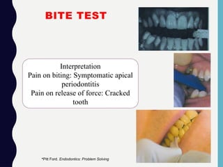 BITE TEST
Interpretation
Pain on biting: Symptomatic apical
periodontitis
Pain on release of force: Cracked
tooth
•Pitt Ford. Endodontics: Problem Solving
 
