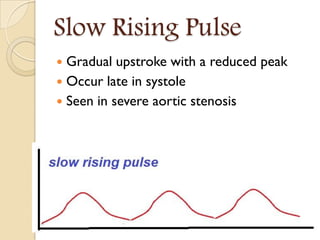 Slow Rising Pulse
 Gradual upstroke with a reduced peak
 Occur late in systole
 Seen in severe aortic stenosis
 