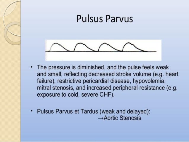 Pulse Abnormal Findings