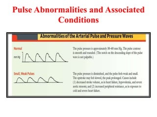 Pulse Abnormalities and Associated
Conditions
 