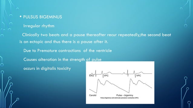 different types of pulse, normal physiology | PPTX