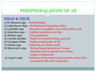 PERIPHERAL SIGNS OF AR
HEAD & NECK
1) De Mussets sign Head bobbing
2) Light House Sign Alt flushing & blanching of face
3) Landolfis sign Alteration in pupillary size with cardiac cycle
3) Quinckies sign Capillary pulsation over lips
4) Mullers sign Uvula pulsation
5) Carotid shudder Thrill over carotid during upstroke
6) Corrigans Pulse Visible carotid pulse of AR
7) Julians sign Pulsation of retinal vessels.
8) Minervini’s sign Strong lingual pulsations. Tongue
depressor moves up and down when
tongue is depressed.
9) Logue’s sign Pulsation of sternoclavicular junction when AR is
associated with aortic dissection.
 