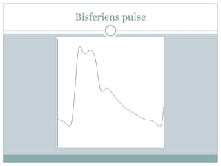 Bisferiens pulse
 