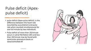 Pulse Deficit Method Pulse and JVP examination.pptx