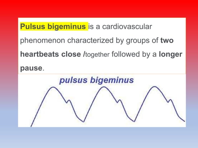PULSE OR HEART RATE,TYPES OF PULSE ,FACTORS AFFECTING AND REGULATION ...