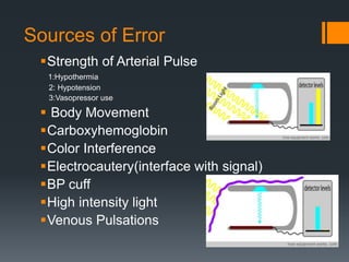 Sources of Error
Strength of Arterial Pulse
1:Hypothermia
2: Hypotension
3:Vasopressor use
 Body Movement
Carboxyhemoglobin
Color Interference
Electrocautery(interface with signal)
BP cuff
High intensity light
Venous Pulsations
 