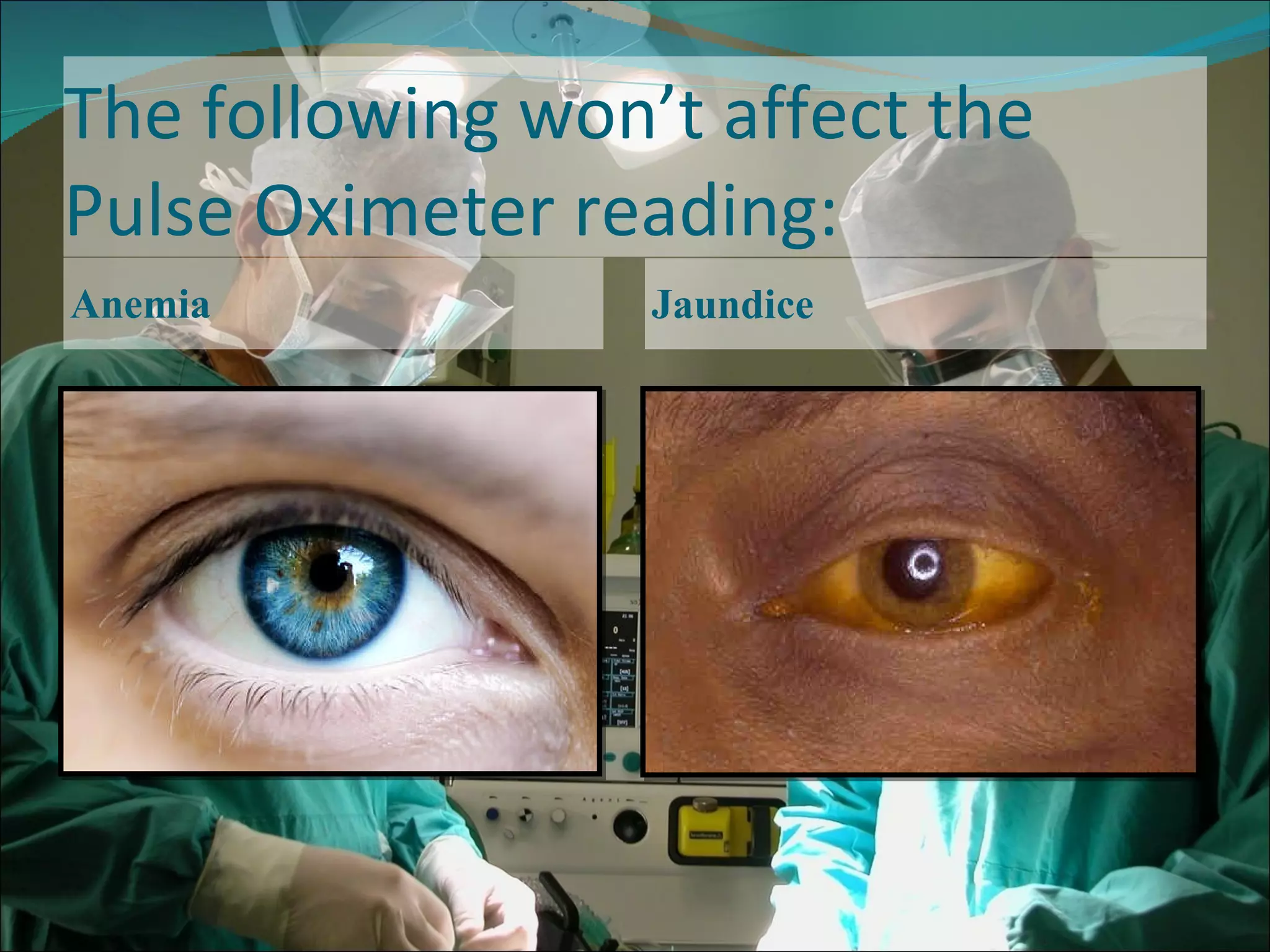 The following won’t affect the Pulse Oximeter reading: Anemia Jaundice 