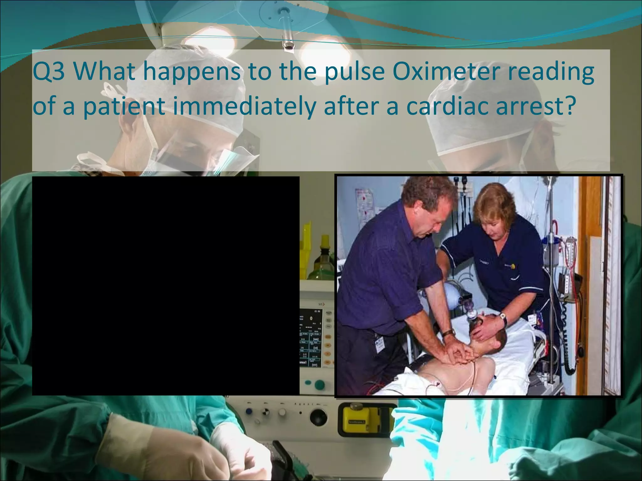 Q3 What happens to the pulse Oximeter reading of a patient immediately after a cardiac arrest?  The pulse would be lost (causing the alarm to sound) and the saturations will decrease 